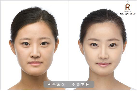 기사 이미지