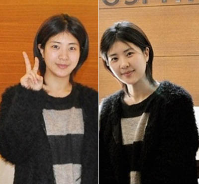 슈스케2 출신 최은, 양악수술 공개에 네티즌
