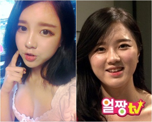 기사 이미지
