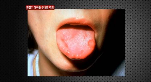 기사 이미지