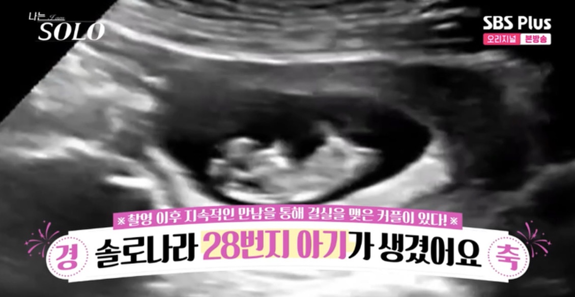 상철·정숙 커플의 초음파 사진