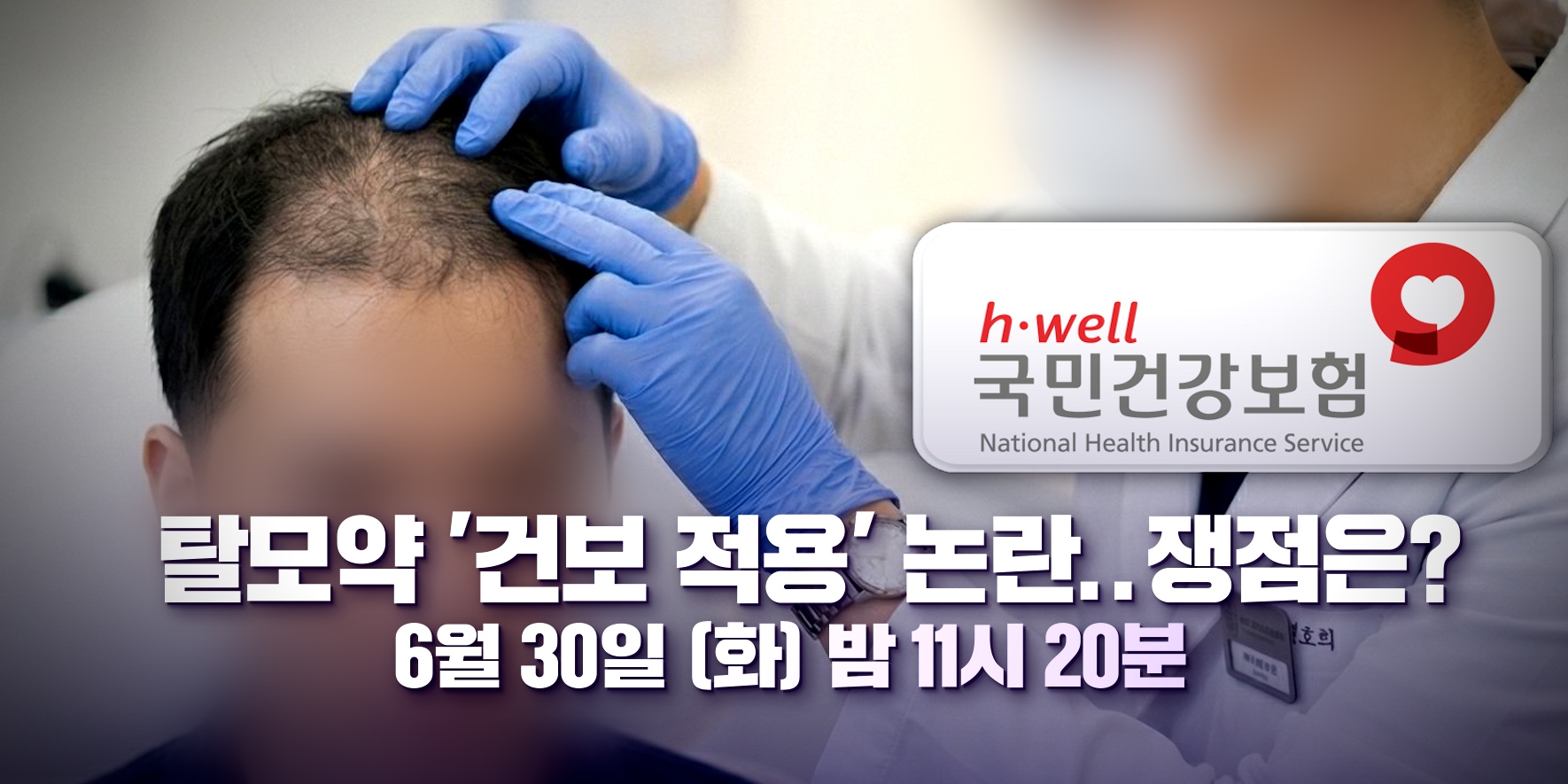 ‘<b>100분토론</b>’ 탈모약 건보 논란, 쟁점은?