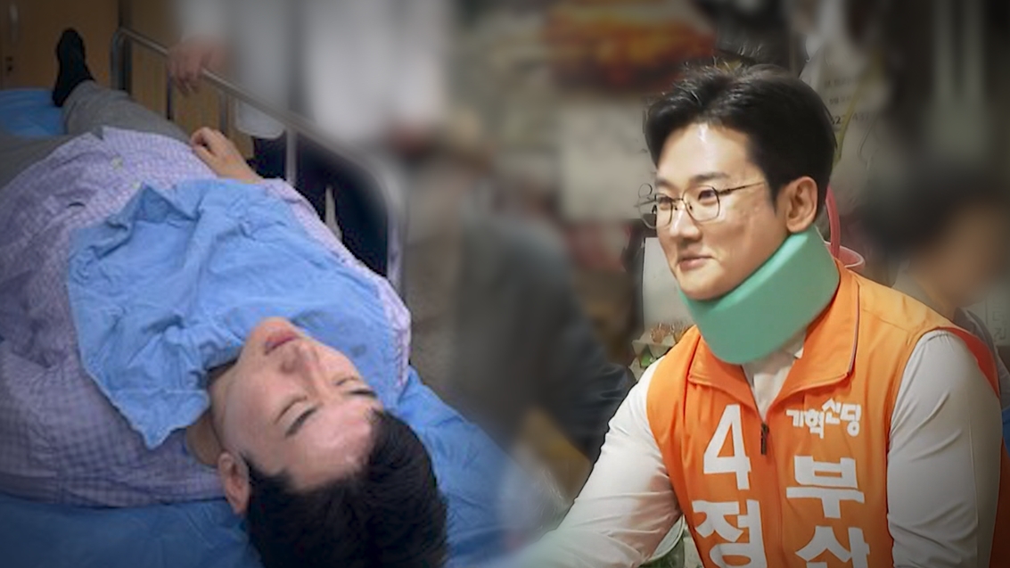 정이한 '테러 자작극' 의혹로 미국 체류설